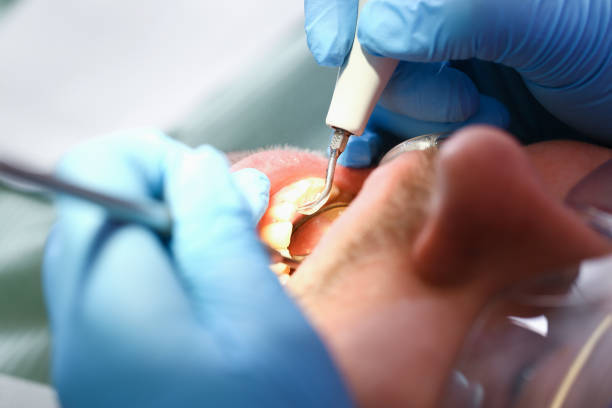 Best Emergency Dental Surgery in Raton, NM
